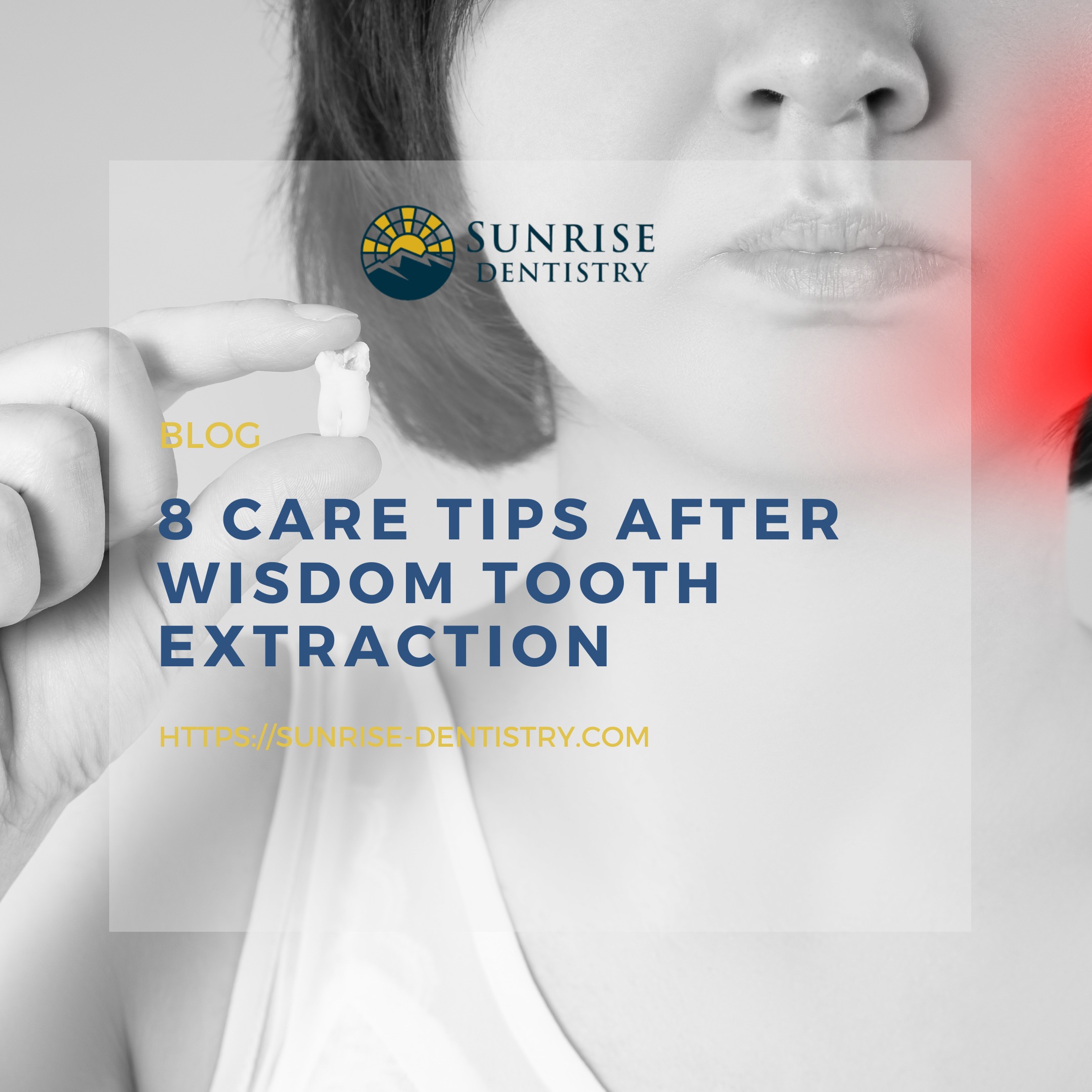 8 Care Tips After Wisdom Tooth Extraction episode artwork