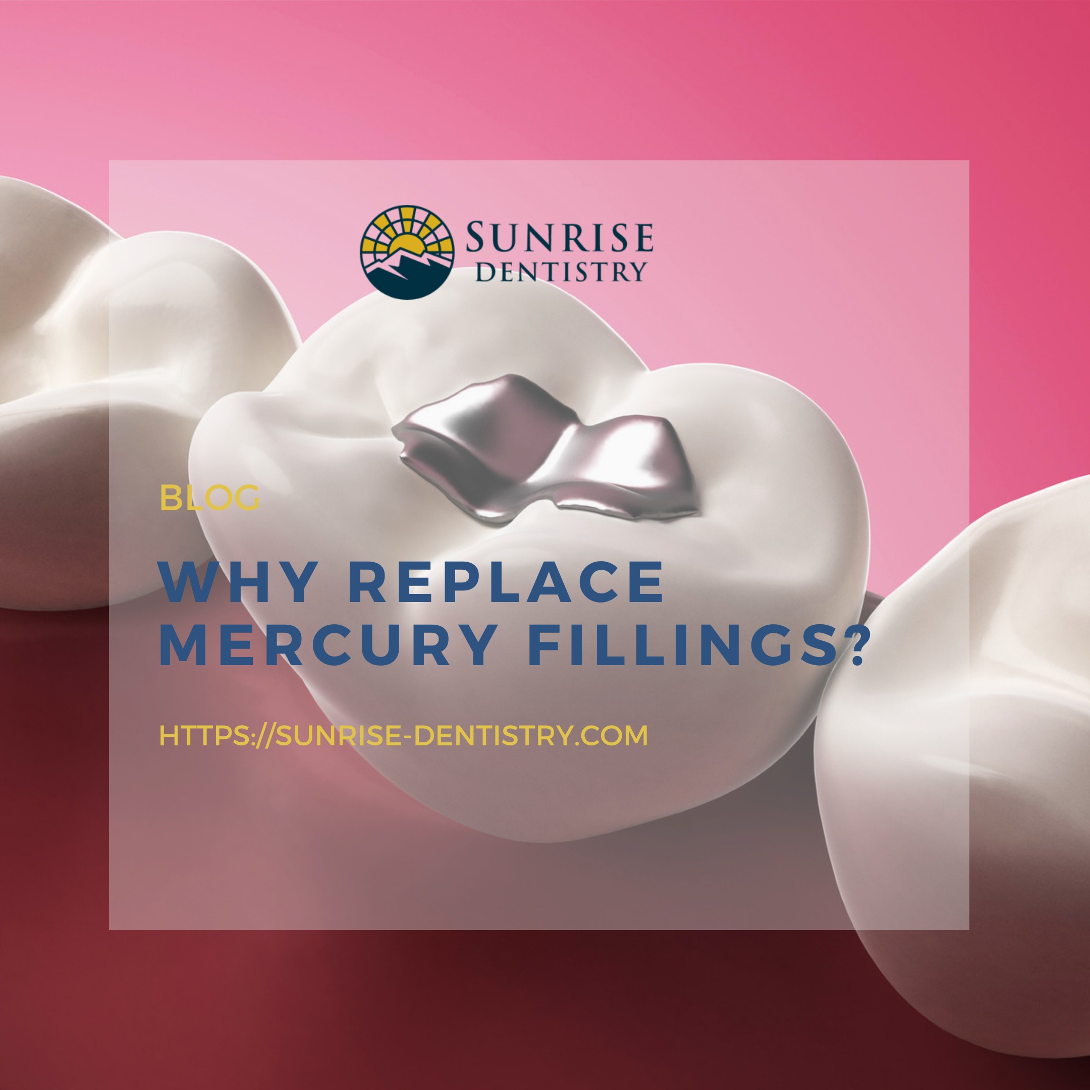 Why Replace Mercury Fillings? episode artwork