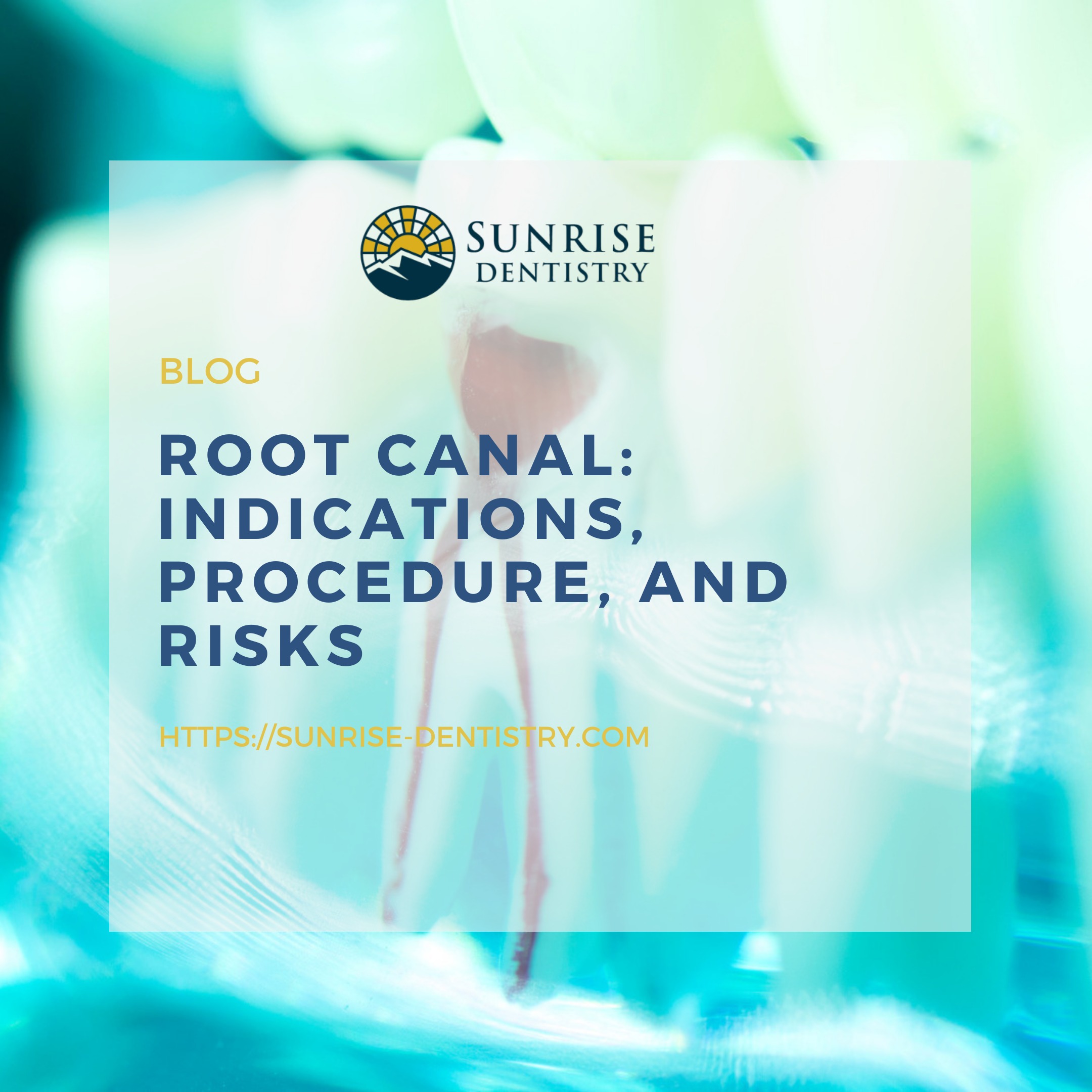 Root Canal: Indications, Procedure, and Risks episode artwork