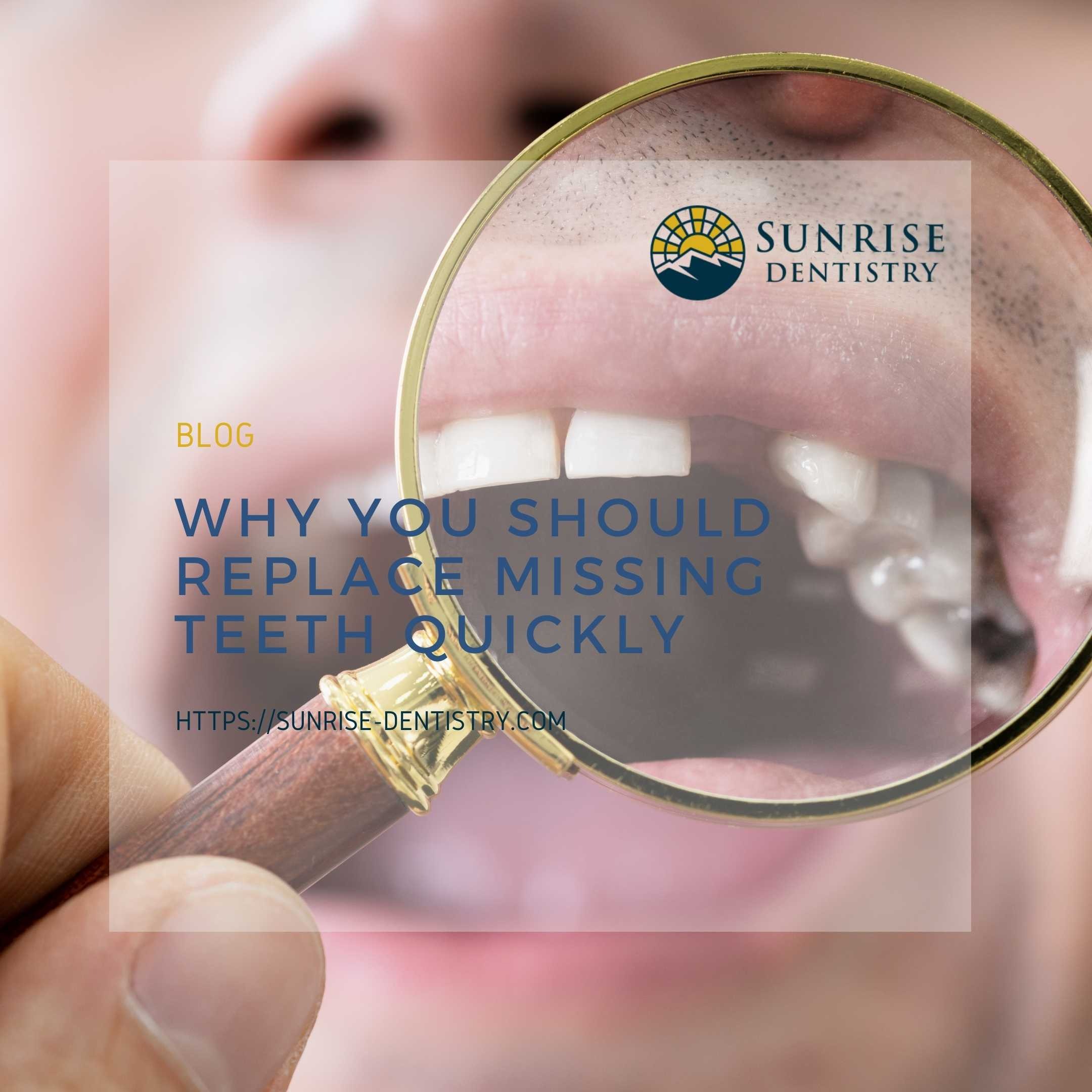 Why You Should Replace Missing Teeth Quickly episode artwork