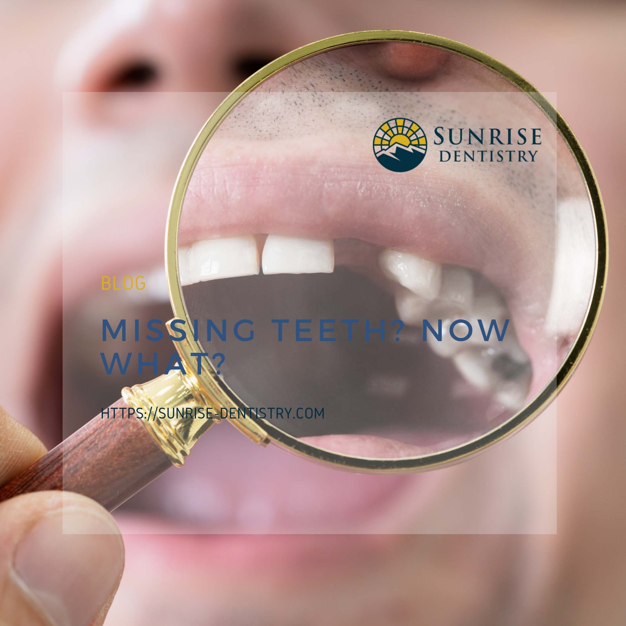 Missing Teeth? Now What? episode artwork