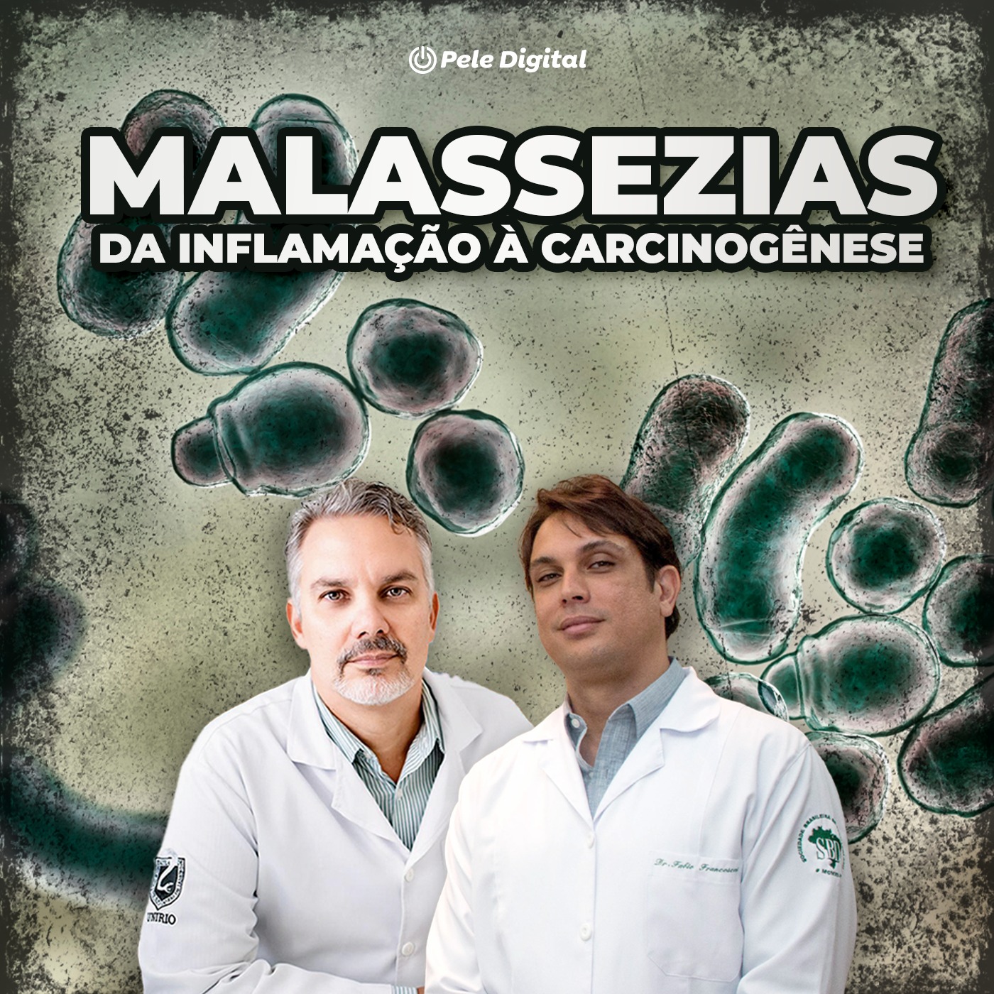 Pele Digital Cast #52 - Malassezias - Da Inflamação à Carcinogênese