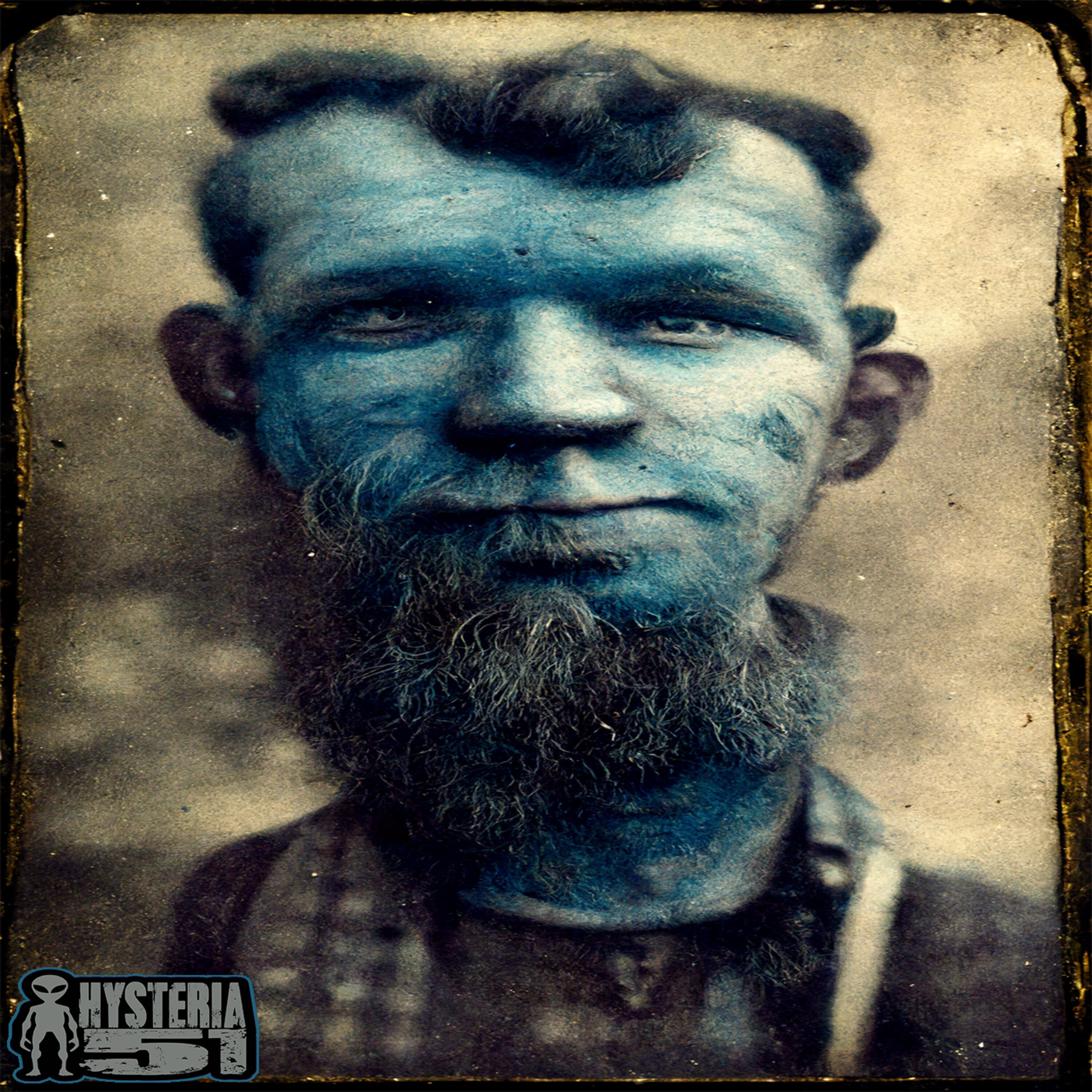 The Fugate Family: The Blue People of Kentucky | 299 Image