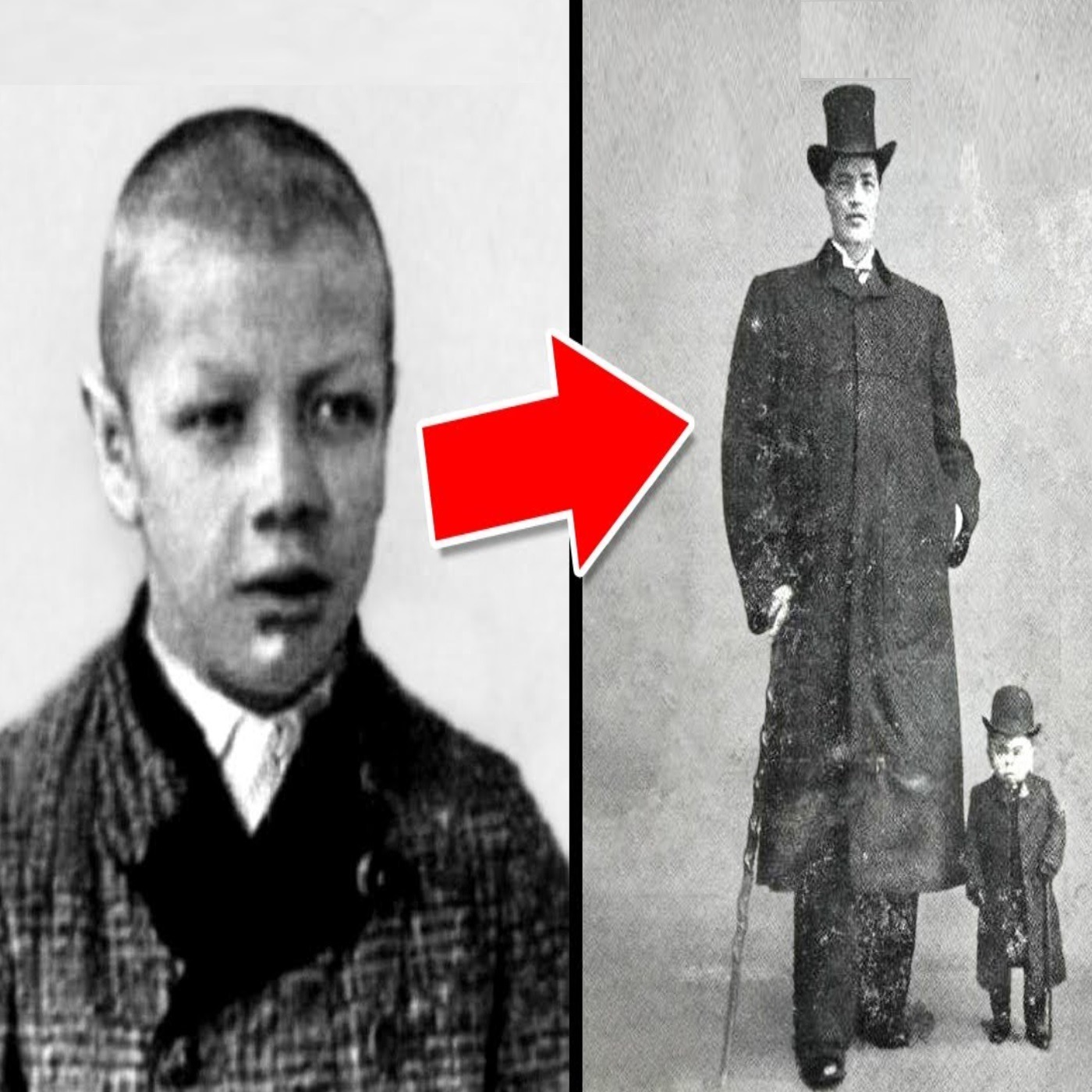 This Man Was Both A Dwarf and A Giant