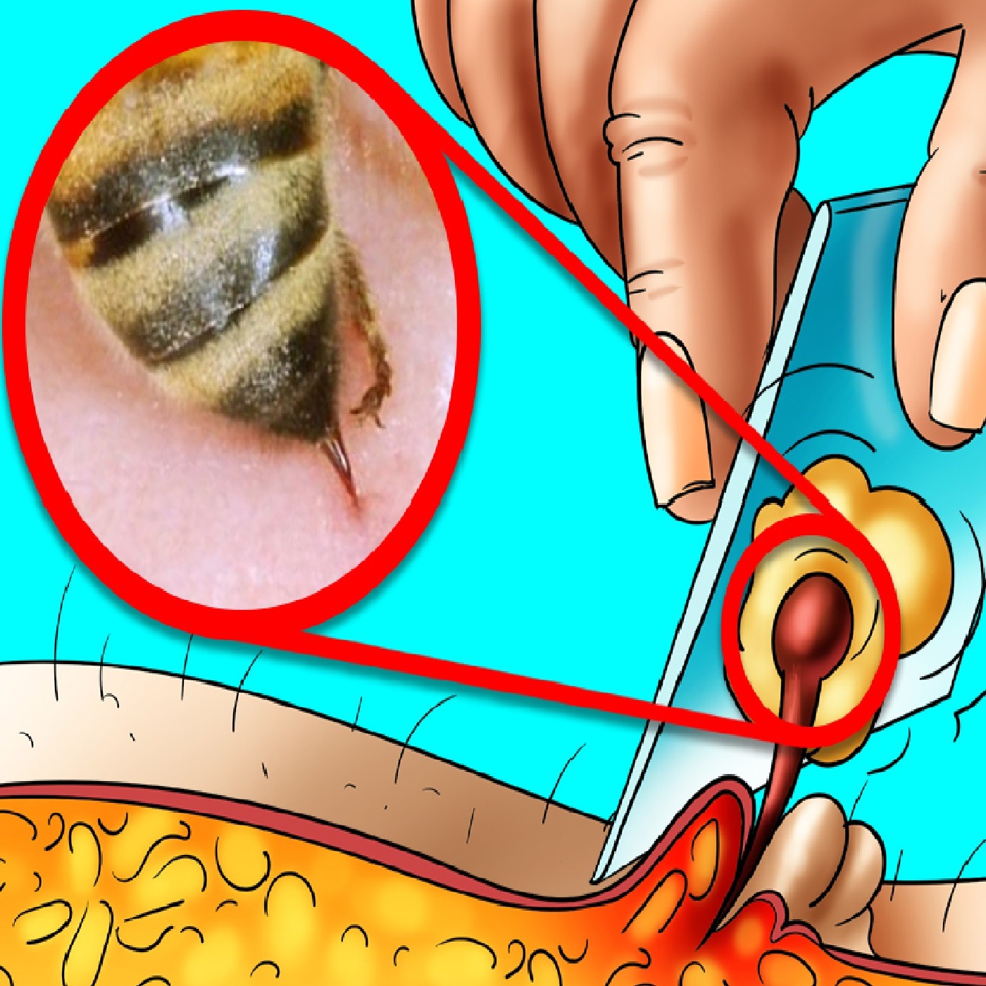 Why Do Bees Die After Stinging?