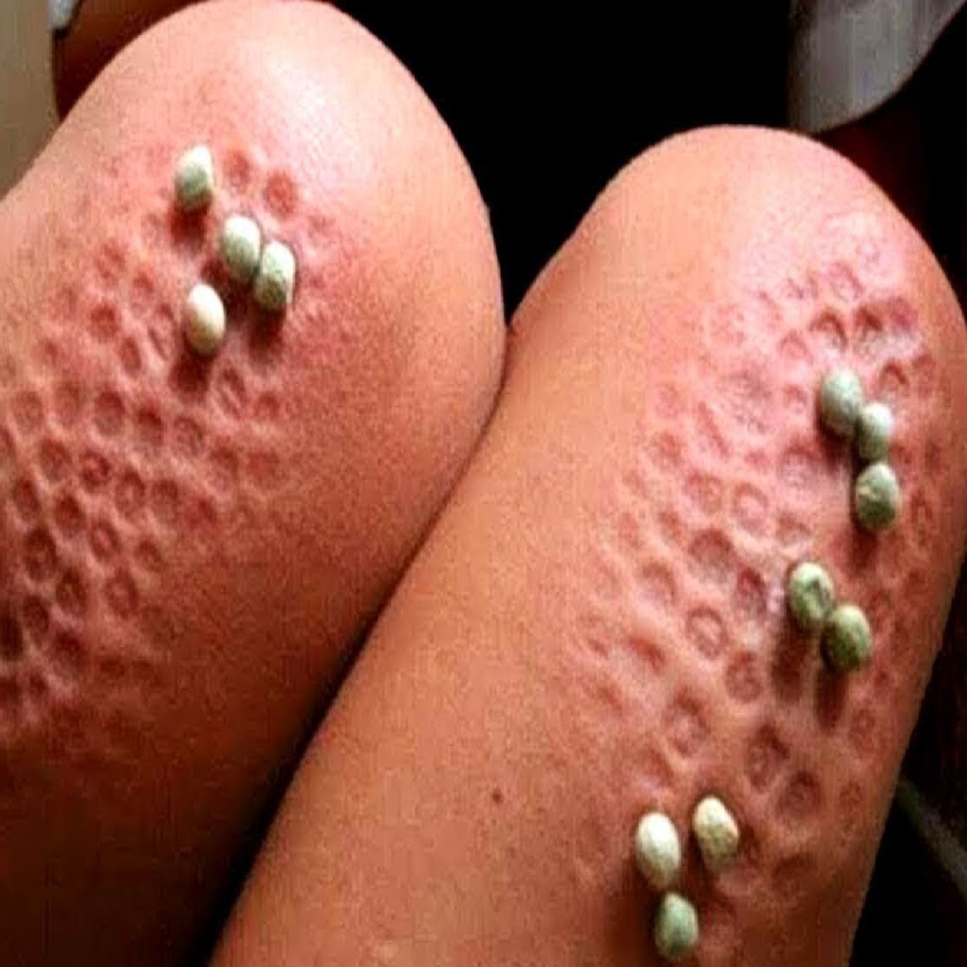 Weirdest Phobias Ever
