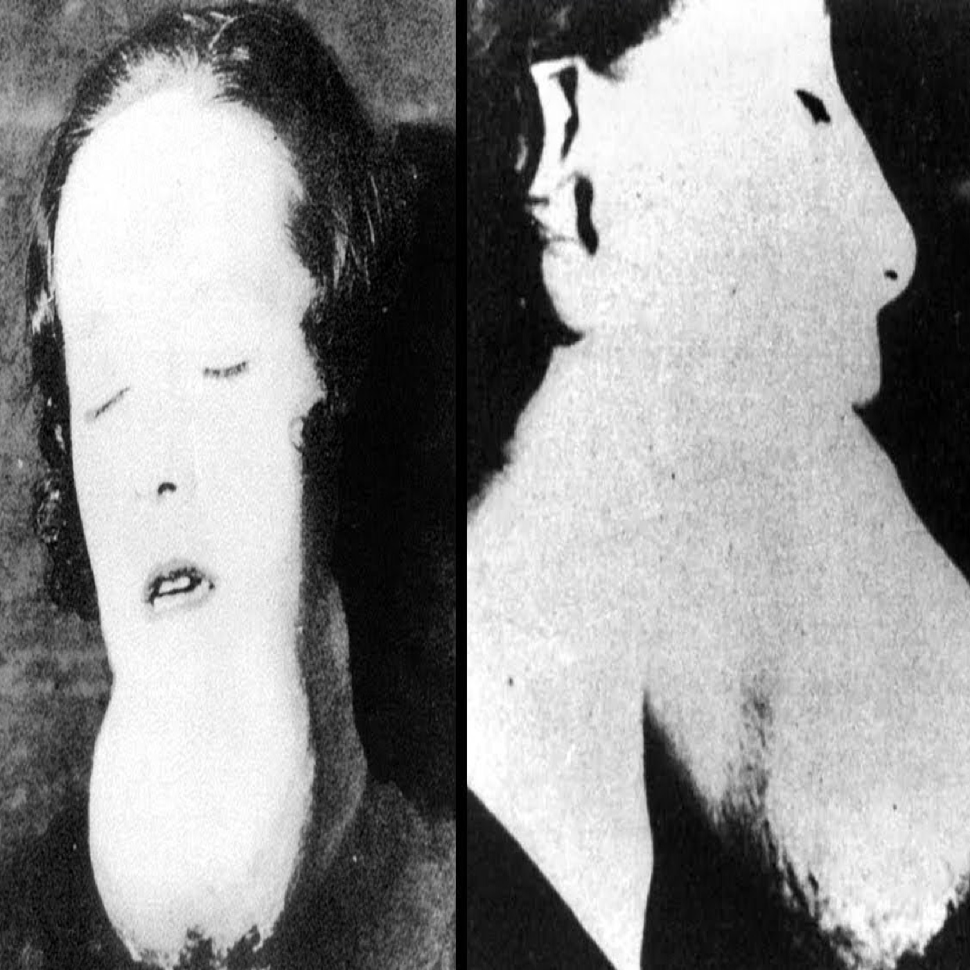 The Terrifying Story of the Radium Girls