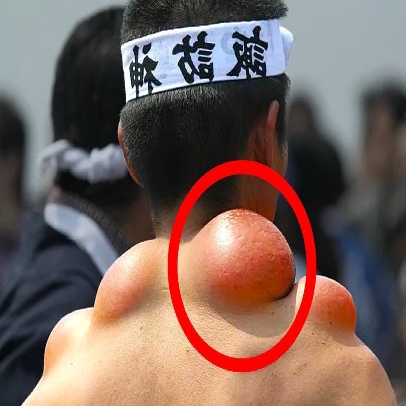 People With Superhuman Abilities That Defy Explanation