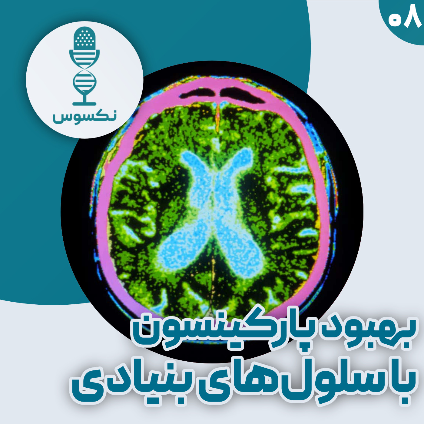 ۸— جهش بزرگ در درمان پارکینسون: علائم بهبود در کارآزمایی‌های بالینی با سلول‌های بنیادی