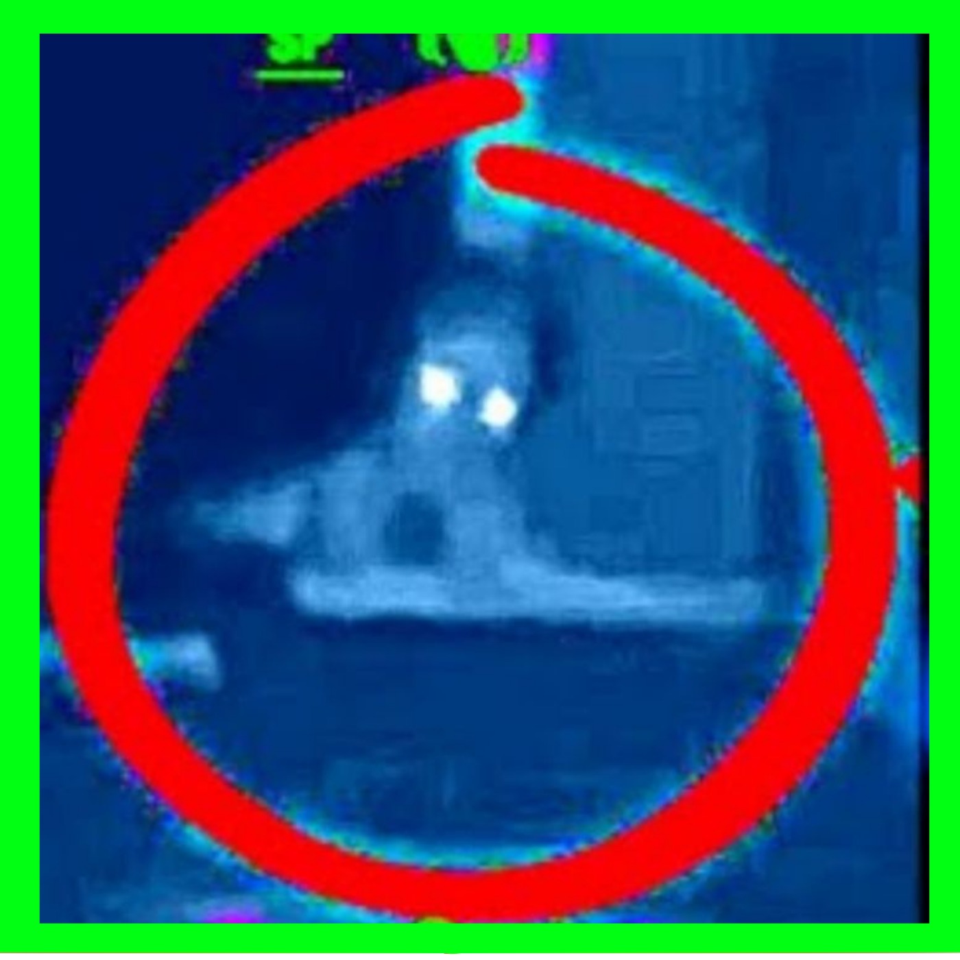 Alien Abductions and Terrifying Alien Encounters True Stories