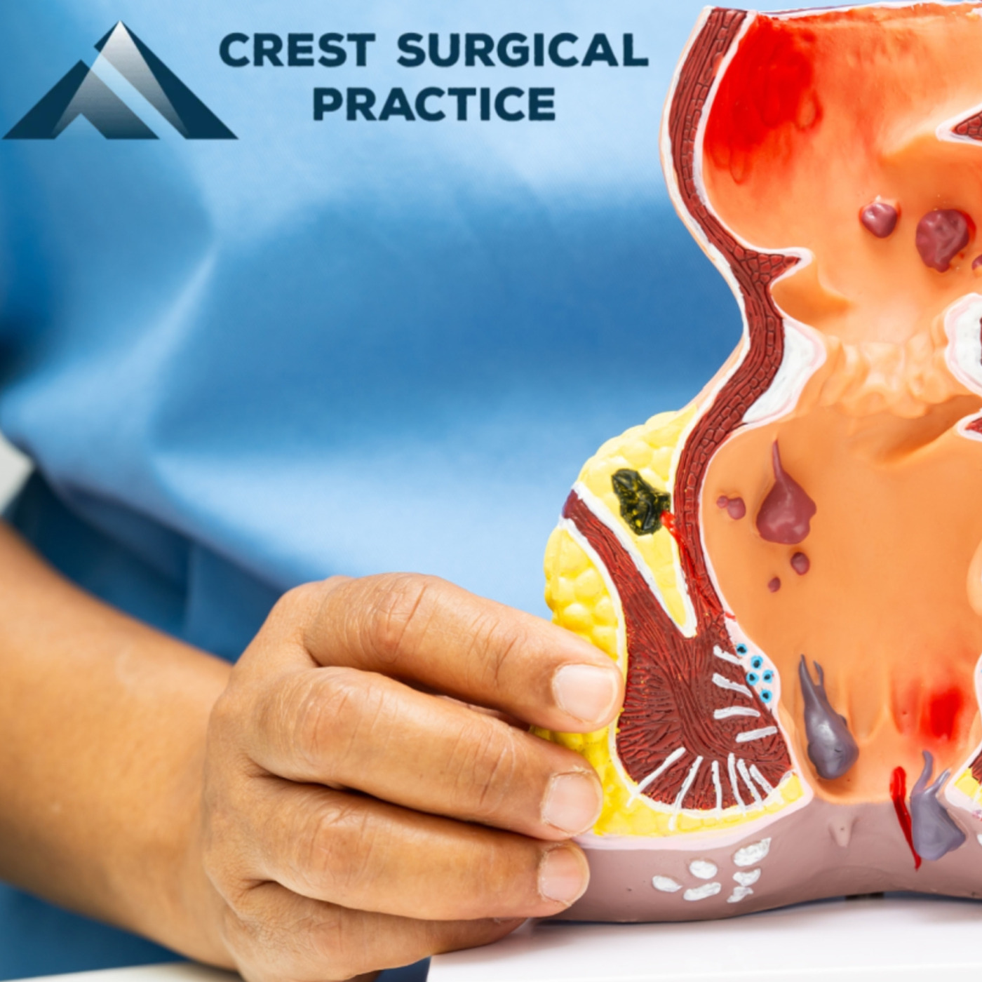 Navigating Modern Surgical Solutions for Chronic Hemorrhoid Relief episode artwork