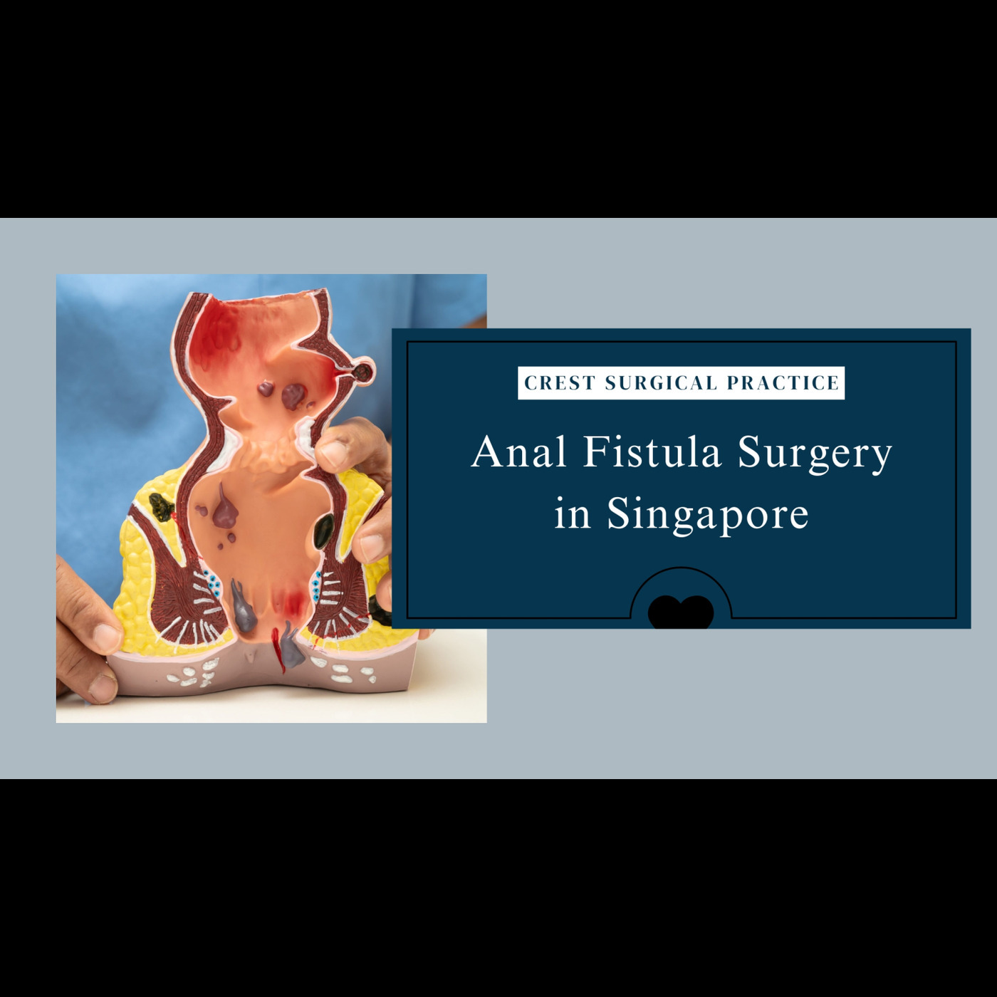Navigating Anal Fistula Treatment and Recovery in Singapore episode artwork