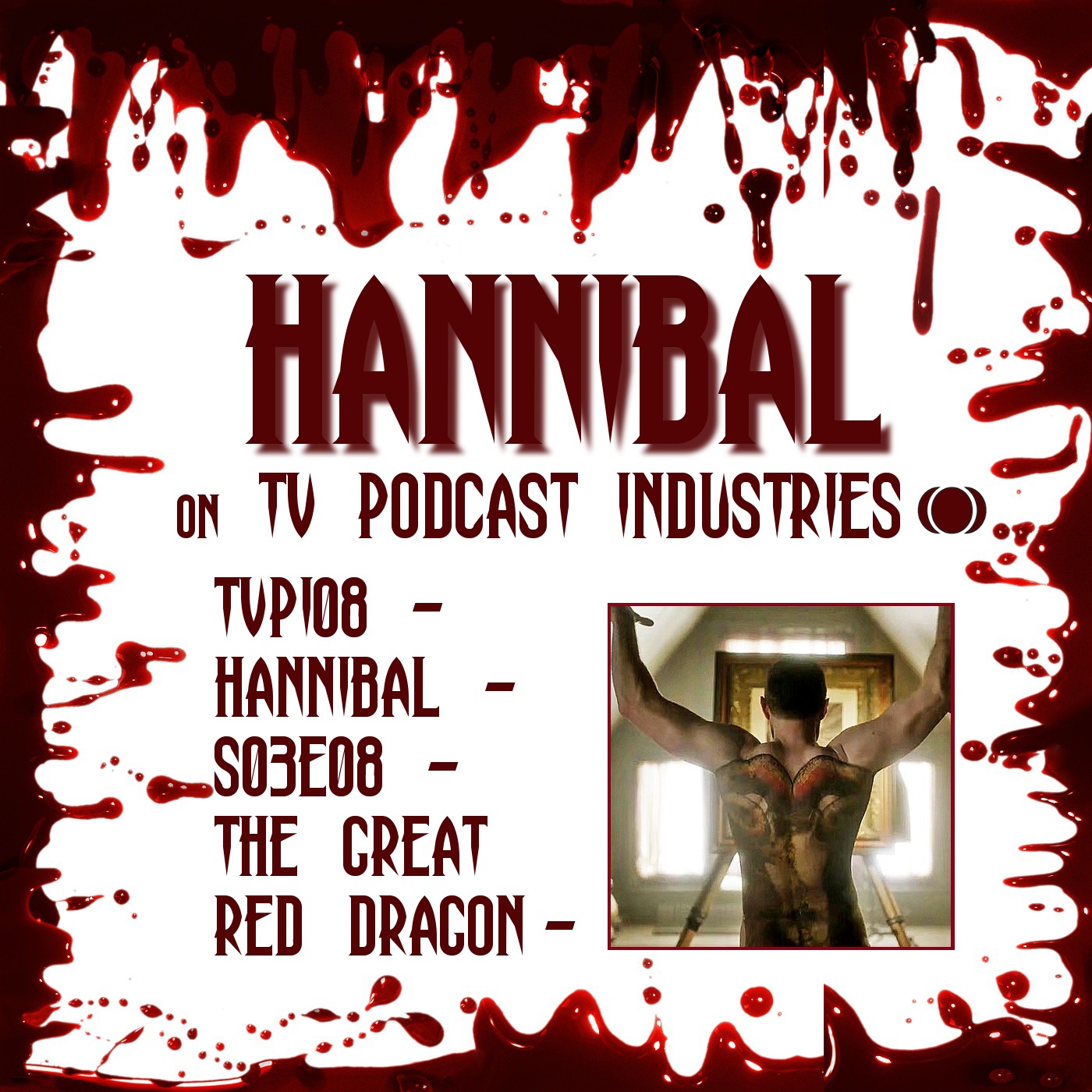 Hannibal Season 3 Episode 8 Review