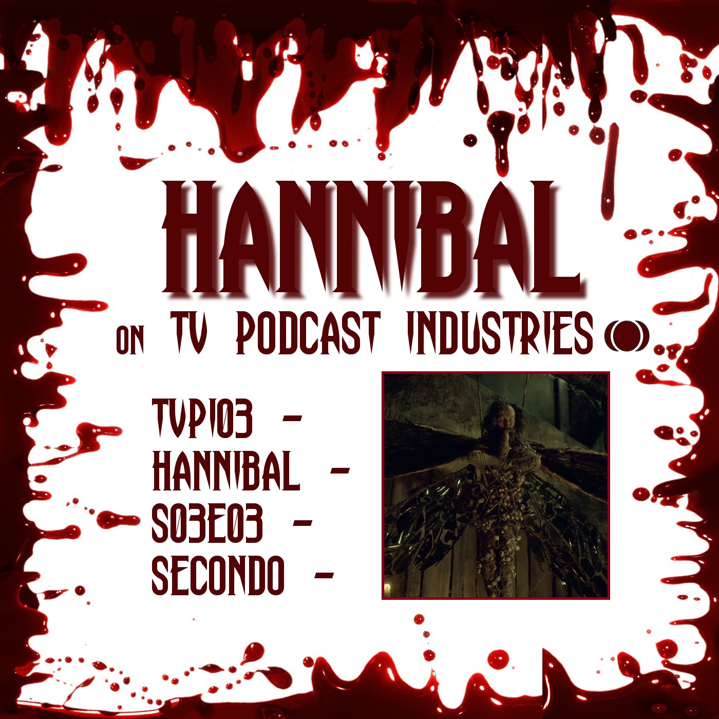 Hannibal Season 3 Episode 3 Review