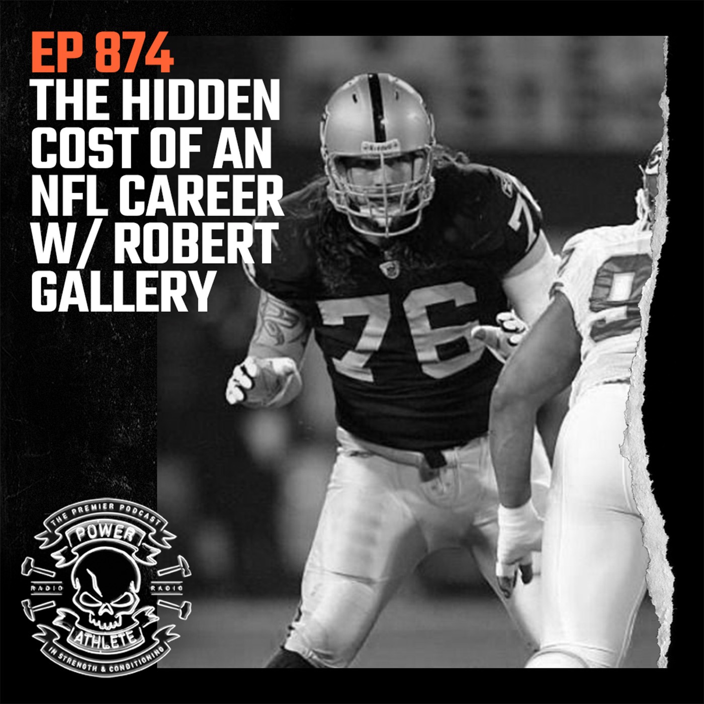 Ep 874: The Hidden Cost of an NFL Career w/ Robert Gallery