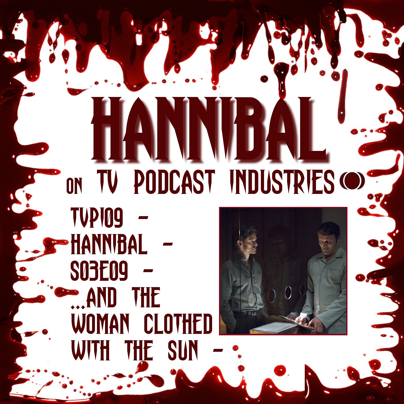 Hannibal Season 3 Episode 9 Review