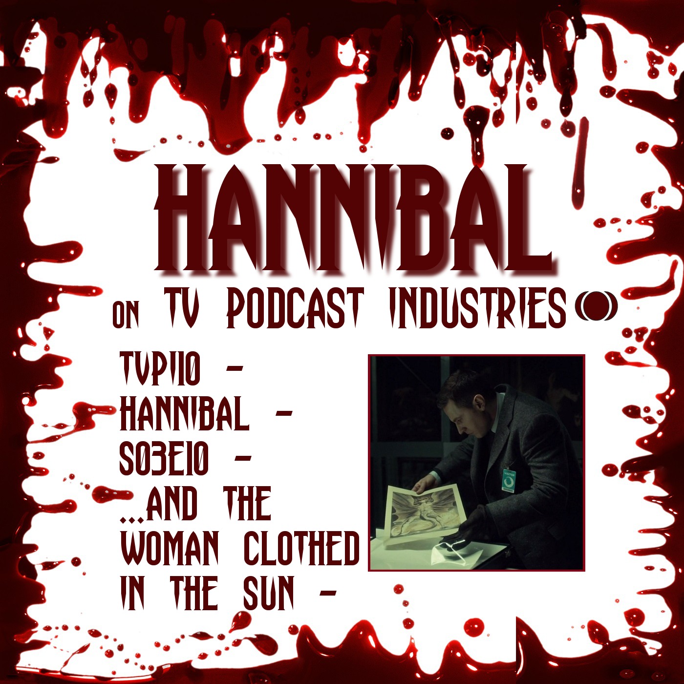 Hannibal Season 3 Episode 10 Review