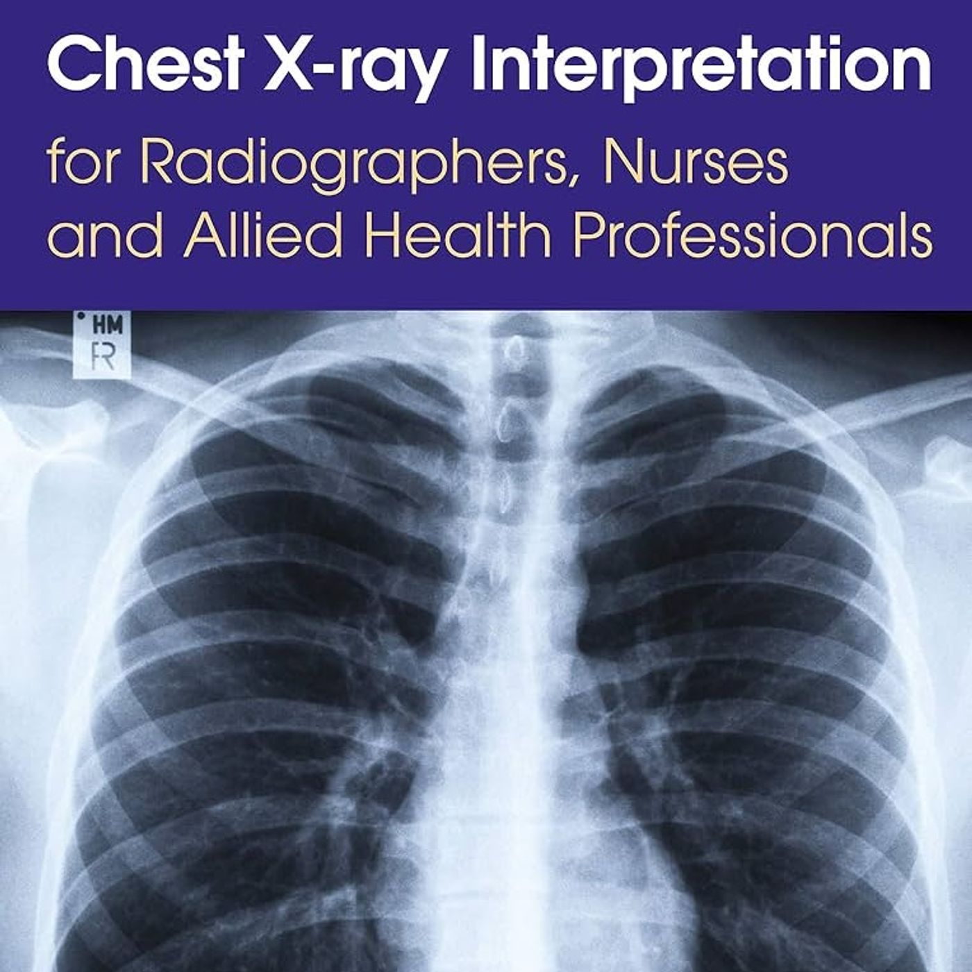 Chest X-ray Interpretation for Radiographers, Nurses and Allied Health Professionals